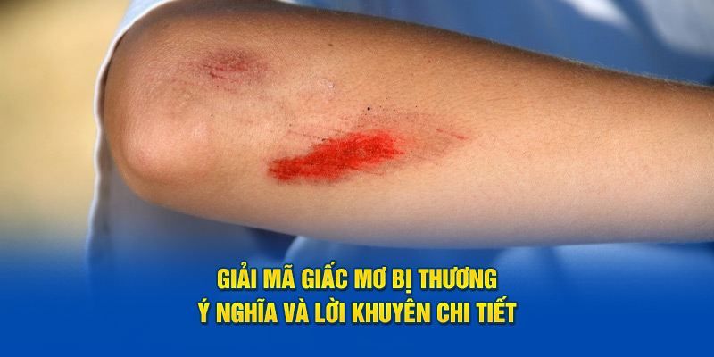 Giải mã giấc mơ bị thương do đâu