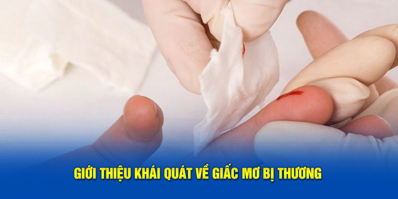 Giới thiệu khái quát về giấc mơ bị thương